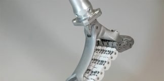 SoftFoot Pro Flexible Prosthetic Foot