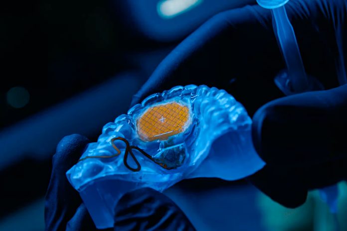 Augmental MouthPad Tongue-based Trackpad