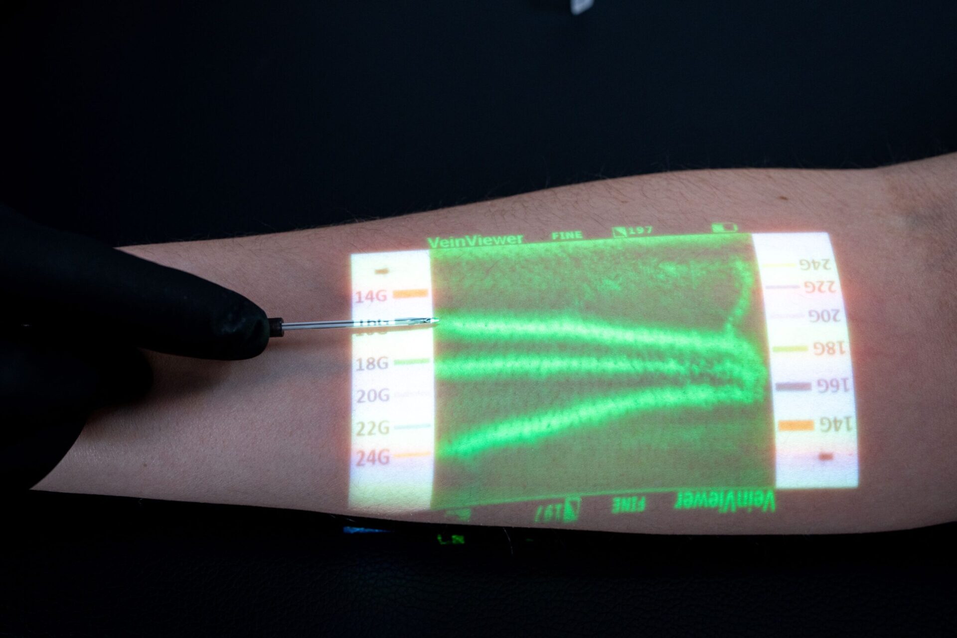 Christie Medical VeinViewer ASSESS Imaging Suite