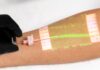 Christie Medical VeinViewer Real-time Vein Mapping