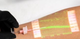Christie Medical VeinViewer Real-time Vein Mapping