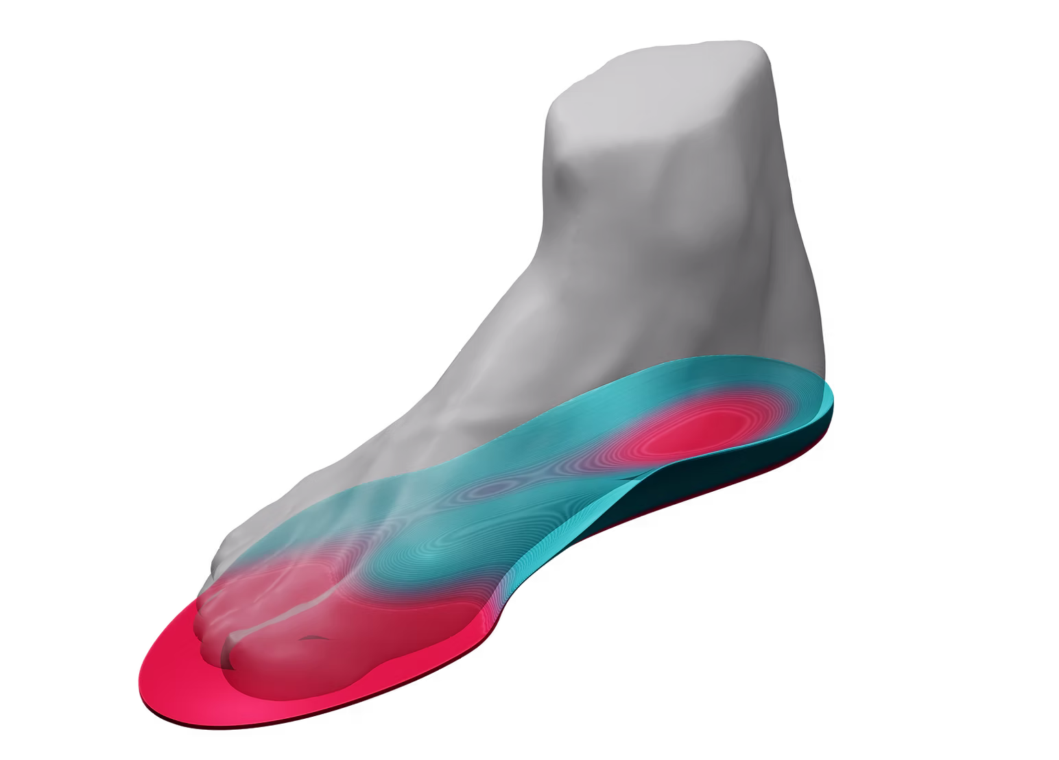 Moxxis Custom Insoles Foot Scan