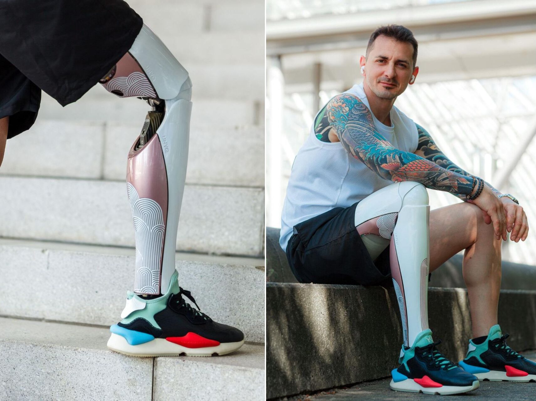 UNYQ OneFit 3D-Printed Prosthetic Cover